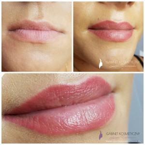 usta permanentne metodą cieniowania